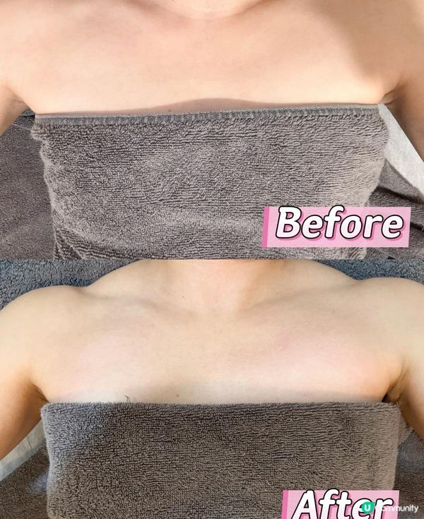 做一次已見效嘅日本豐胸造乳術！