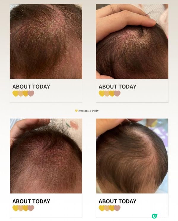 🇲🇫Biolane法國貝兒🧼🫧🧴 還我靚靚頭💫