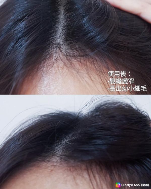 【實測】HAIR FORCE防脫髮精華光學導入精華⭐