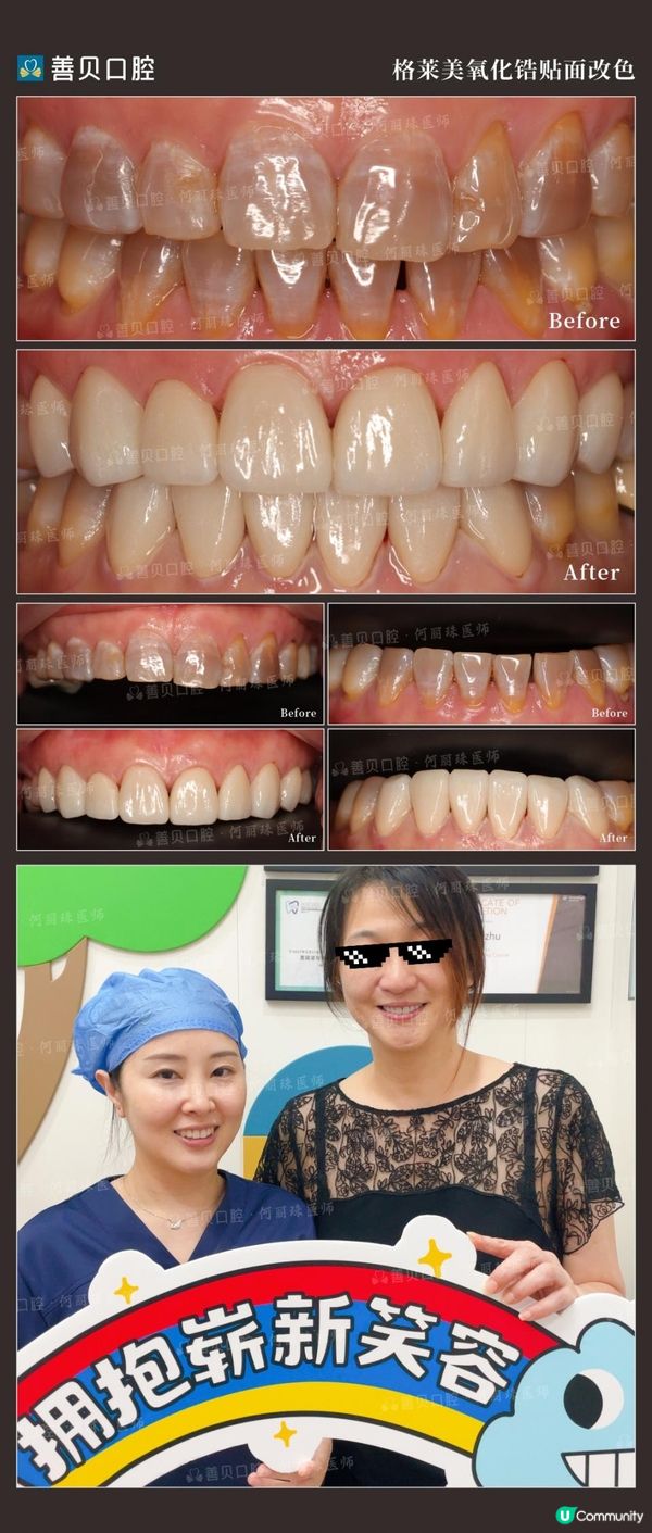 杜牙根第二隻半價