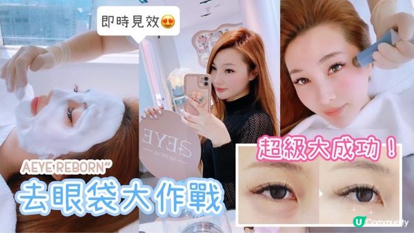 【美容分享】去眼袋大作戰…（超級大成功!!）│ 無痛無創 │ 去眼袋 │ 去黑眼圈 │ 去眼紋 │ AEYE REBORN │ 去眼袋‧直升肌療程 │ AEYE Medical