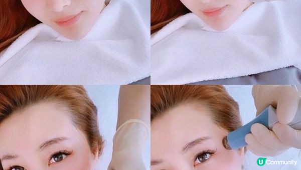 【美容分享】去眼袋大作戰…（超級大成功!!）│ 無痛無創 │ 去眼袋 │ 去黑眼圈 │ 去眼紋 │ AEYE REBORN │ 去眼袋‧直升肌療程 │ AEYE Medical