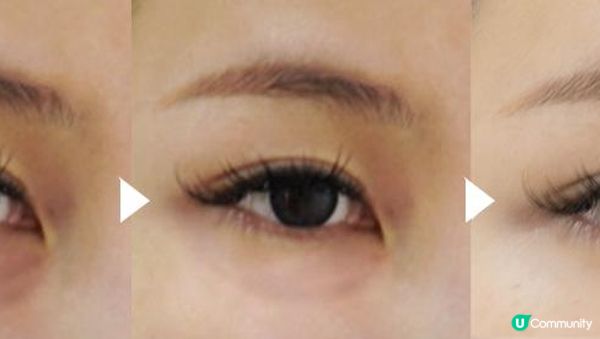 【美容分享】去眼袋大作戰…（超級大成功!!）│ 無痛無創 │ 去眼袋 │ 去黑眼圈 │ 去眼紋 │ AEYE REBORN │ 去眼袋‧直升肌療程 │ AEYE Medical