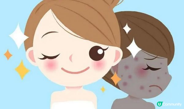 新機Sylfirm X矽谷電波 K.O. 凹凸洞效果：絕呀！只係一次皮膚滑返唒！