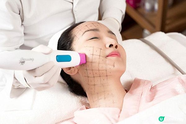 HIFU VS Thermage的分別【瘦面效果大比拼】