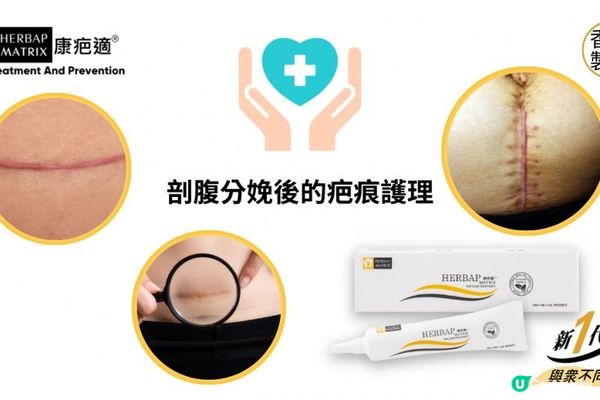 開刀生仔與剖腹產疤痕修復全攻略！2025最新科研突破與黃金護理期指南