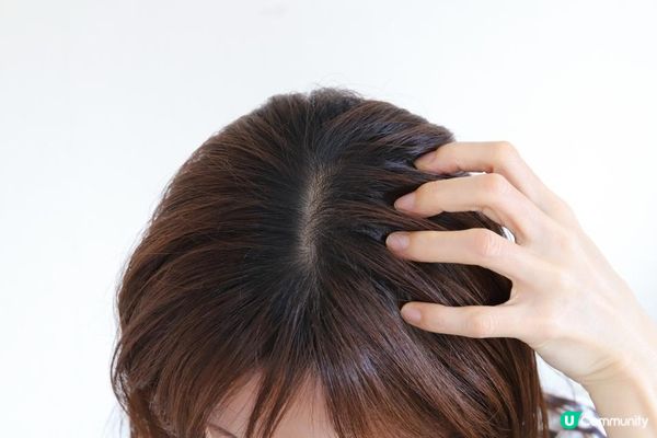 掉髮適合吃什麼保健食品？結合脂漏性皮膚炎洗髮精的保養建議