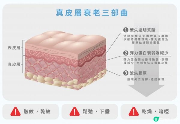 btl膠原槍有什麼功效？選對好機構效果翻倍！