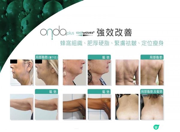 私心推介！ONDA PLUS$988放題1小時？🤣希望少d人睇到!千祈唔好去單次收費美容院做減肥！😆