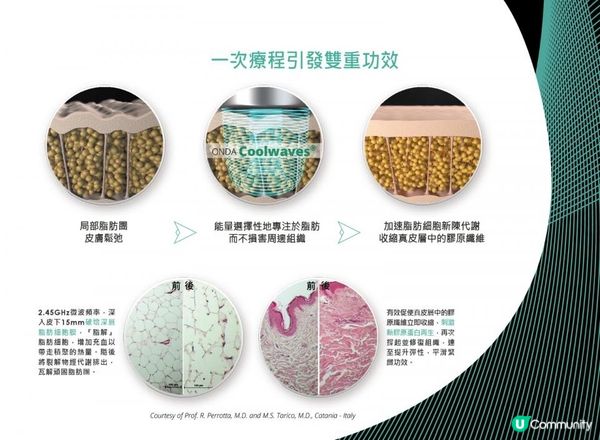 私心推介！ONDA PLUS$988放題1小時？🤣希望少d人睇到!千祈唔好去單次收費美容院做減肥！😆