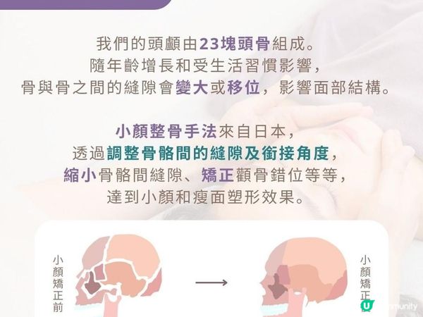 小顏整骨初體驗...即時瘦了4mm！