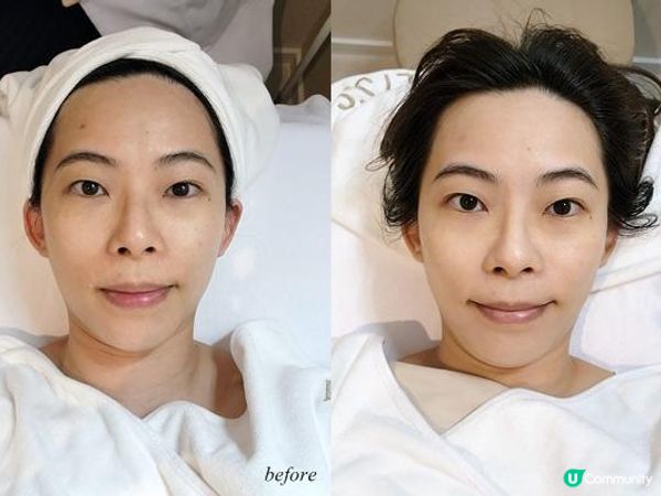 對付M前亂爆瘡 - ALYSSA BEAUTY 肌源28