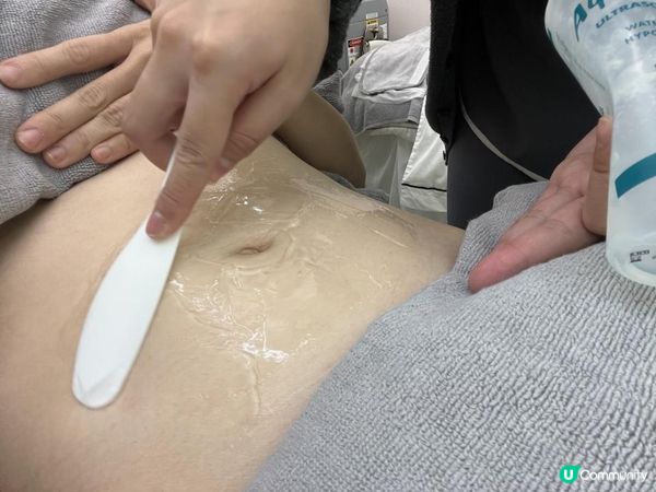  Love Share Beauty❤️「肚紋擦子膠」