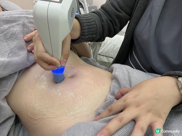  Love Share Beauty❤️「肚紋擦子膠」