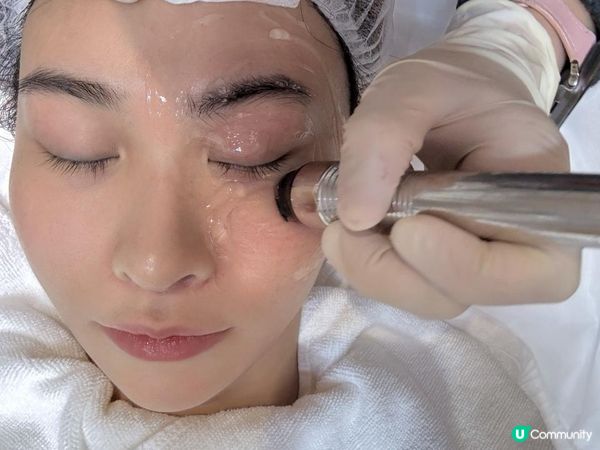 🌟 讓雙眼重拾精靈光采！INMODE眼部緊膚療程體驗分享 🌟