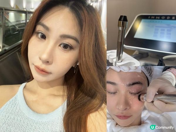 🌟 讓雙眼重拾精靈光采！INMODE眼部緊膚療程體驗分享 🌟