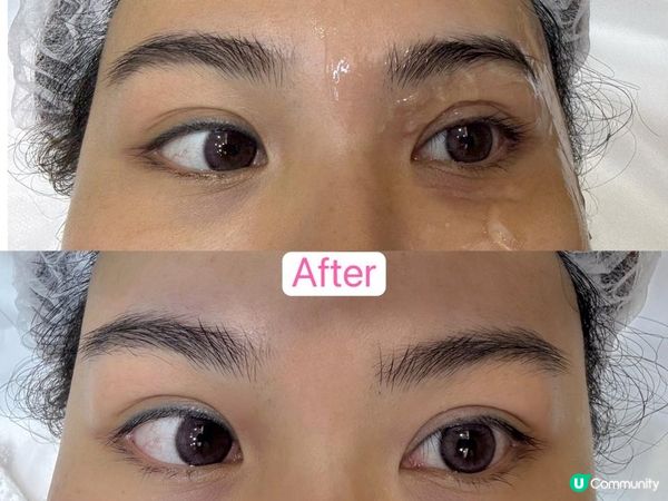 🌟 讓雙眼重拾精靈光采！INMODE眼部緊膚療程體驗分享 🌟