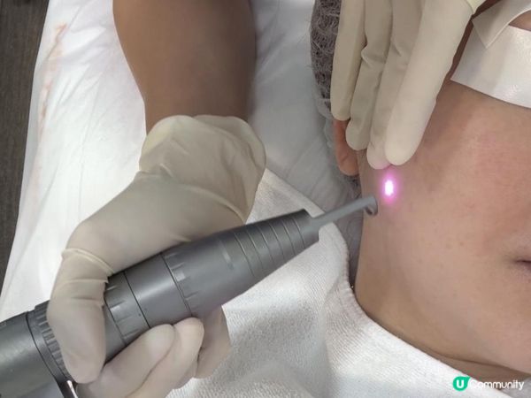 分享: MEDSKIN PLUS【LUTRONIC Spectra 醫學級美白去斑激光】