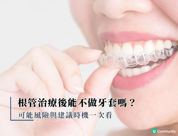 根管治療後能不做牙套嗎？可能風險與建議時機一次看
