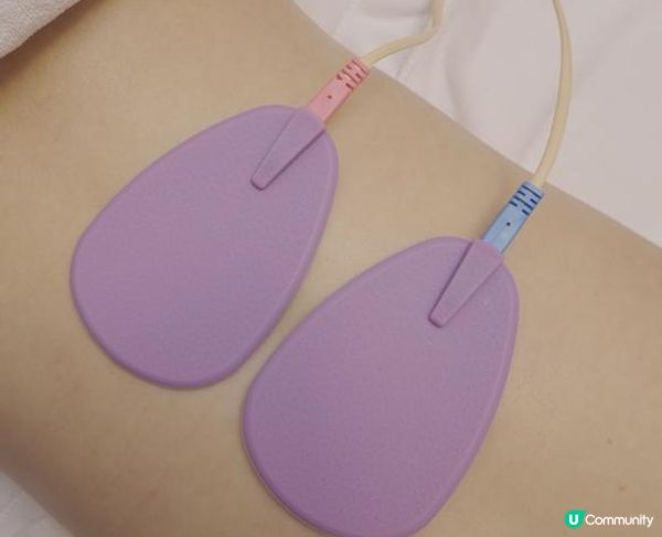 【試後感 – 痛症治療】AI無痛針灸師好唔好?