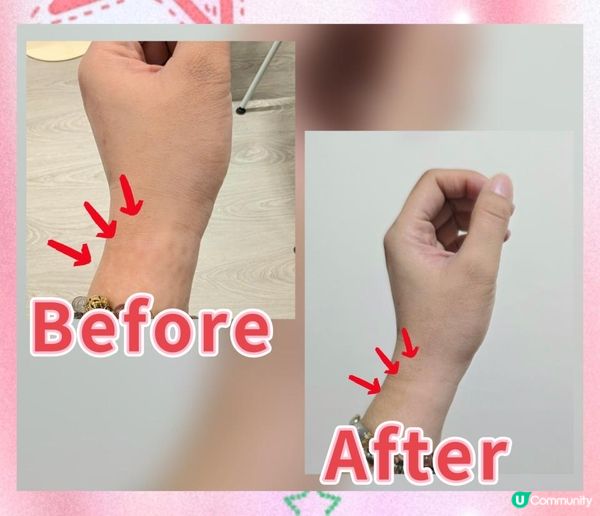 ColliG 化濕輕 怯除浮腫