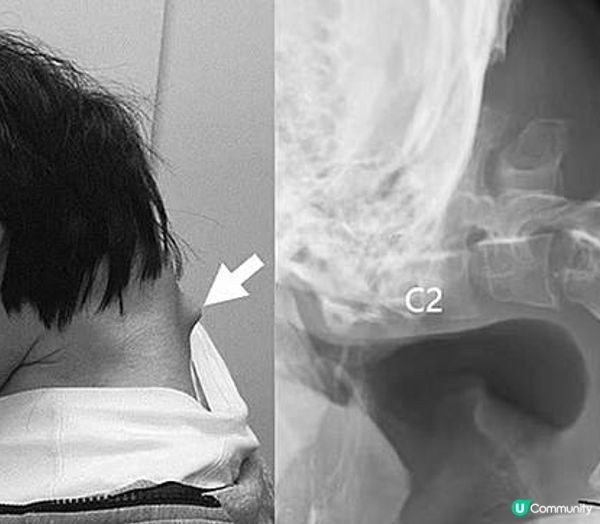 低頭族危機與親子數位教養：手機使用的建議指南 (適用於7-18歲的孩子)