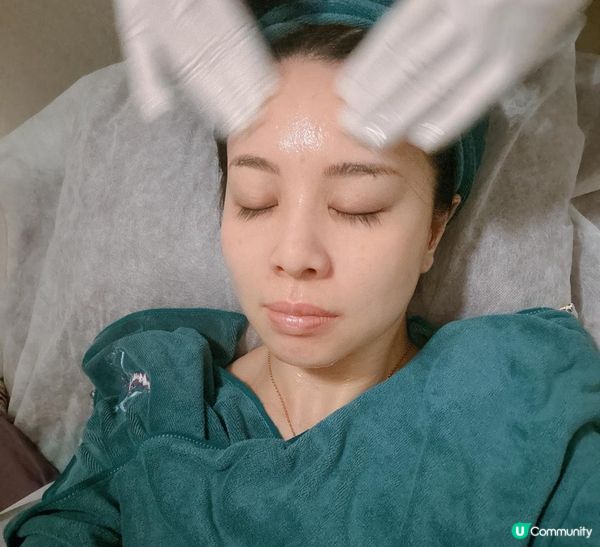 【YOU SKY BEAUTY】初試日式小顏矯正術