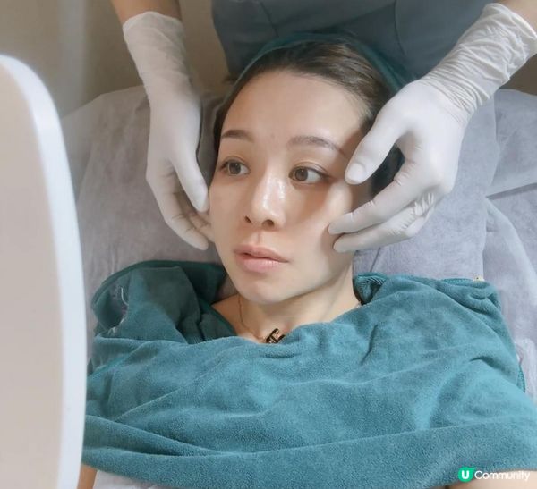 【YOU SKY BEAUTY】初試日式小顏矯正術