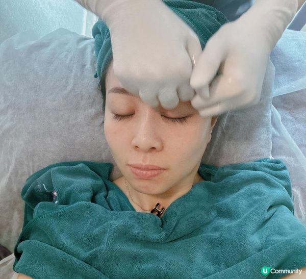 【YOU SKY BEAUTY】初試日式小顏矯正術