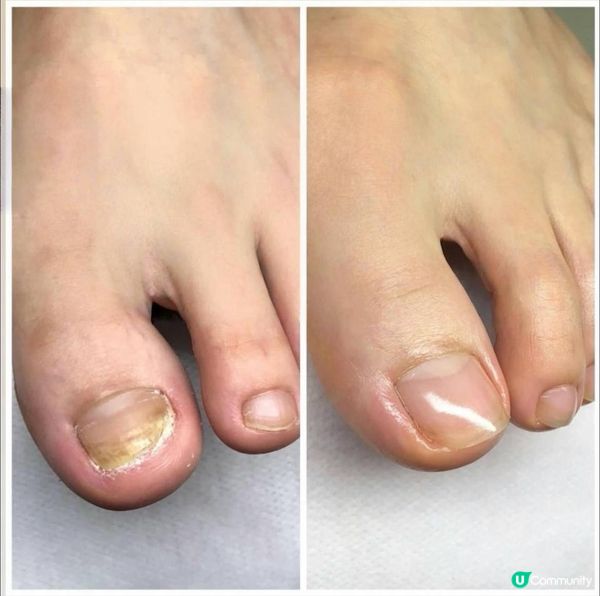 《三間灰甲試後感》想改善灰甲，邊間好？💅🏻