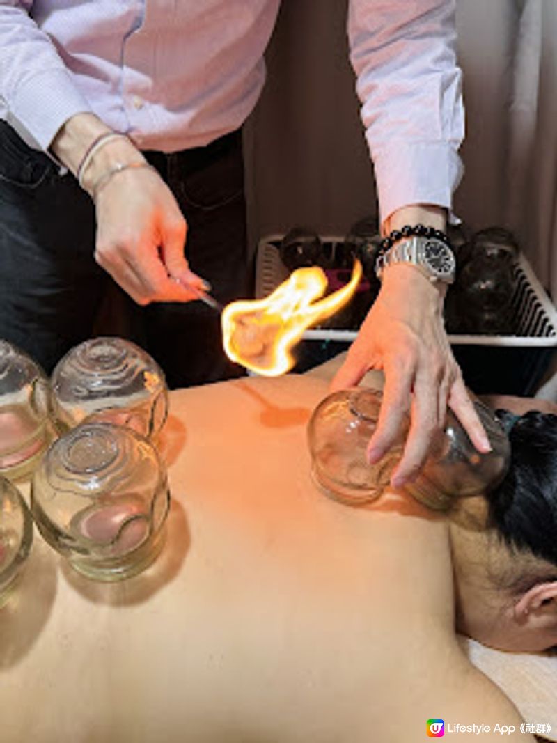 香港中醫館推介! 養康中醫館王牌拔火罐袪濕氣療程