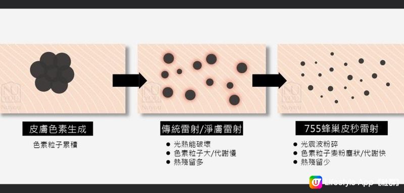 【2024最新皮秒技術】 2024年最新皮秒去斑效果太驚人 ! (慎入)